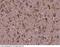 Cell Division Cycle 37 antibody, 50826-T60, Sino Biological, Immunohistochemistry paraffin image 