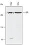 ATR Serine/Threonine Kinase antibody, AF4717, R&D Systems, Western Blot image 