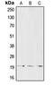 CD3d Molecule antibody, LS-C351950, Lifespan Biosciences, Western Blot image 