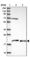 Cysteine and glycine-rich protein 2 antibody, NBP2-13879, Novus Biologicals, Western Blot image 