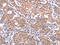 Gamma-Aminobutyric Acid Type A Receptor Alpha1 Subunit antibody, CSB-PA522630, Cusabio, Immunohistochemistry paraffin image 