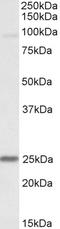 NADH:Ubiquinone Oxidoreductase Core Subunit S8 antibody, LS-C186562, Lifespan Biosciences, Western Blot image 