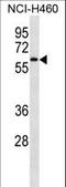 Interleukin 1 Receptor Associated Kinase 4 antibody, LS-C165284, Lifespan Biosciences, Western Blot image 