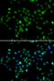 RB Binding Protein 6, Ubiquitin Ligase antibody, STJ29046, St John