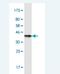 Deoxythymidylate Kinase antibody, H00001841-M02-100ug, Novus Biologicals, Western Blot image 