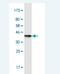 Thymidylate kinase antibody, H00001841-M02-100ug, Novus Biologicals, Western Blot image 