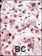 AXL Receptor Tyrosine Kinase antibody, 63-029, ProSci, Immunohistochemistry paraffin image 