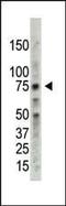 Protein Arginine Methyltransferase 5 antibody, PA5-11122, Invitrogen Antibodies, Western Blot image 