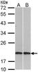 Cofilin 2 antibody, LS-C186322, Lifespan Biosciences, Western Blot image 