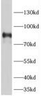 Periostin antibody, FNab06315, FineTest, Western Blot image 