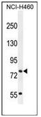 Solute Carrier Organic Anion Transporter Family Member 4C1 antibody, AP53931PU-N, Origene, Western Blot image 