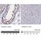 Coiled-Coil Domain Containing 97 antibody, NBP1-91768, Novus Biologicals, Immunohistochemistry paraffin image 