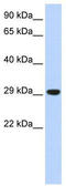 Transcription Factor A, Mitochondrial antibody, TA344229, Origene, Western Blot image 