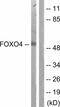 Forkhead Box O4 antibody, ab63254, Abcam, Western Blot image 