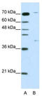 Zinc Finger Protein 668 antibody, TA345397, Origene, Western Blot image 