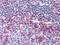 CD69 Molecule antibody, MA5-15612, Invitrogen Antibodies, Immunohistochemistry paraffin image 