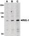 DExD/H-Box Helicase 58 antibody, LS-C19644, Lifespan Biosciences, Western Blot image 