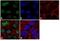 Vitamin D Receptor antibody, MA5-14617, Invitrogen Antibodies, Immunofluorescence image 