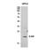 Interleukin 36 Beta antibody, A08643, Boster Biological Technology, Western Blot image 