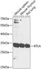 B And T Lymphocyte Associated antibody, GTX33076, GeneTex, Western Blot image 