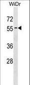 Autophagy Related 4D Cysteine Peptidase antibody, LS-C156405, Lifespan Biosciences, Western Blot image 