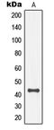 Mitogen-Activated Protein Kinase Kinase 4 antibody, GTX32260, GeneTex, Western Blot image 