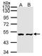 Adenylate Kinase 9 antibody, GTX108308, GeneTex, Western Blot image 