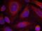 Synaptotagmin 1 antibody, PA5-37750, Invitrogen Antibodies, Immunofluorescence image 