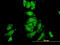 Proteasome 26S Subunit, Non-ATPase 10 antibody, LS-B10019, Lifespan Biosciences, Immunofluorescence image 