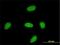 Yes Associated Protein 1 antibody, H00010413-M02, Novus Biologicals, Immunocytochemistry image 