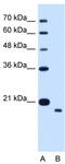 Transmembrane Protein 91 antibody, TA335951, Origene, Western Blot image 