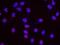 E1A Binding Protein P400 antibody, NB200-210, Novus Biologicals, Proximity Ligation Assay image 