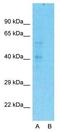 Pentraxin 3 antibody, GTX45054, GeneTex, Western Blot image 