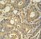 Tryptase Delta 1 antibody, LS-C160150, Lifespan Biosciences, Immunohistochemistry paraffin image 
