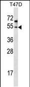 Zinc Finger DHHC-Type Containing 6 antibody, PA5-48717, Invitrogen Antibodies, Western Blot image 