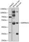 Serpin Family A Member 3 antibody, 18-819, ProSci, Western Blot image 