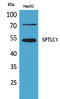 Serine Palmitoyltransferase Long Chain Base Subunit 1 antibody, STJ96597, St John