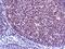 X-Ray Repair Cross Complementing 6 antibody, GTX03316, GeneTex, Immunohistochemistry paraffin image 