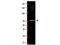 RAD23 Homolog B, Nucleotide Excision Repair Protein antibody, GTX85831, GeneTex, Western Blot image 