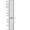 Testis Specific Serine Kinase 6 antibody, abx219162, Abbexa, Western Blot image 