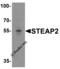 STEAP2 Metalloreductase antibody, 4307, ProSci, Western Blot image 