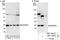 Ubiquitin Conjugating Enzyme E2 E2 antibody, NBP1-80573, Novus Biologicals, Immunoprecipitation image 