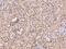 Protein HEXIM1 antibody, 201439-T10, Sino Biological, Immunohistochemistry paraffin image 