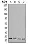 DEAD-Box Helicase 5 antibody, orb256492, Biorbyt, Western Blot image 