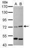 Eukaryotic Translation Initiation Factor 2 Alpha Kinase 1 antibody, PA5-29409, Invitrogen Antibodies, Western Blot image 