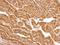 Ubiquitin Conjugating Enzyme E2 O antibody, GTX119315, GeneTex, Immunohistochemistry paraffin image 