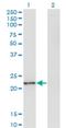 Twist-related protein 2 antibody, H00117581-M06, Novus Biologicals, Western Blot image 
