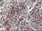 Interleukin 10 Receptor Subunit Alpha antibody, M03597-1, Boster Biological Technology, Immunohistochemistry paraffin image 