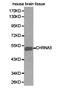 Cholinergic Receptor Nicotinic Alpha 5 Subunit antibody, LS-C192737, Lifespan Biosciences, Western Blot image 