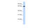 Ribophorin I antibody, 25-610, ProSci, Western Blot image 
